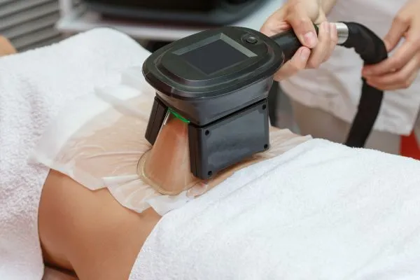 Image of person having fat freezing treatment to help weight gain Pinner