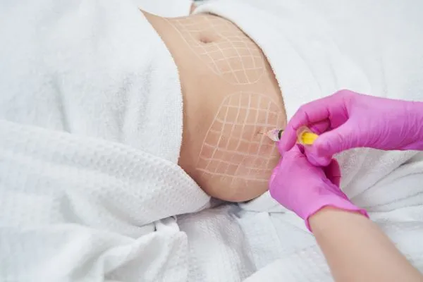 image of fat dissolving injections on love handles to help combat weight gain Pinner