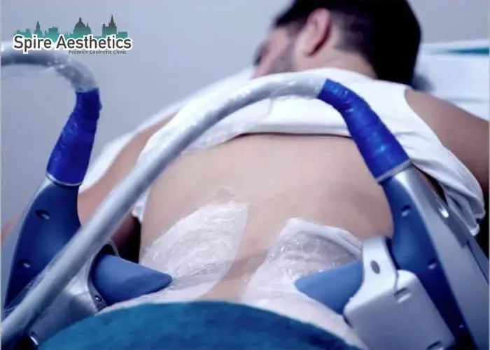 Man having fat freezing treatment done on love handles before a competitions Pinner to create a sculpted look.