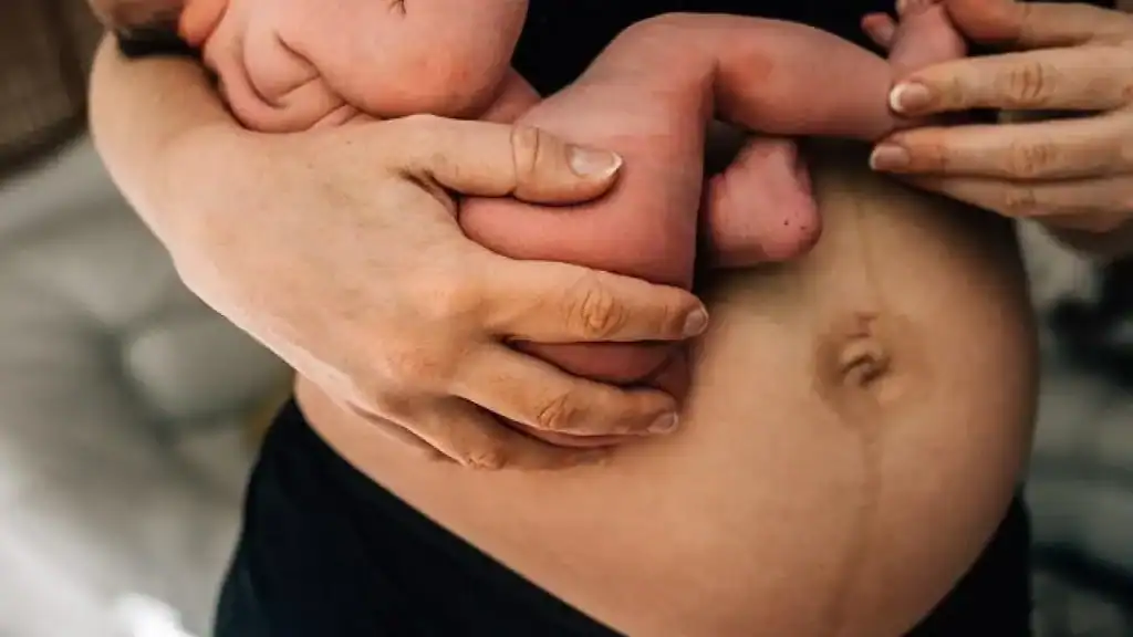 Why Is My Stomach Still Big After Pregnancy Pinner?